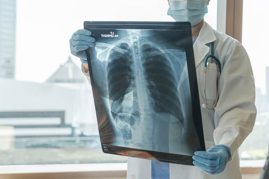 Photo of a doctor holding up a chest x-ray